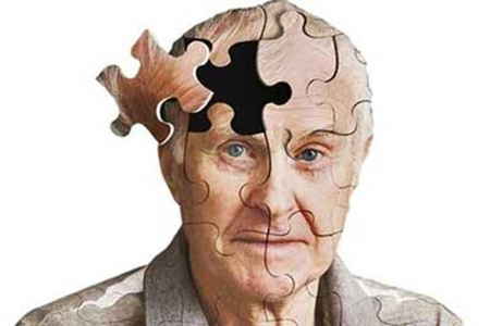علائم بیماری آلزایمر