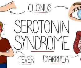 سندرم سروتونین